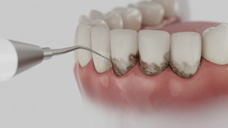 Reliable Dental Implants contractor in Jamestown, ND by Smile Center Dentistry